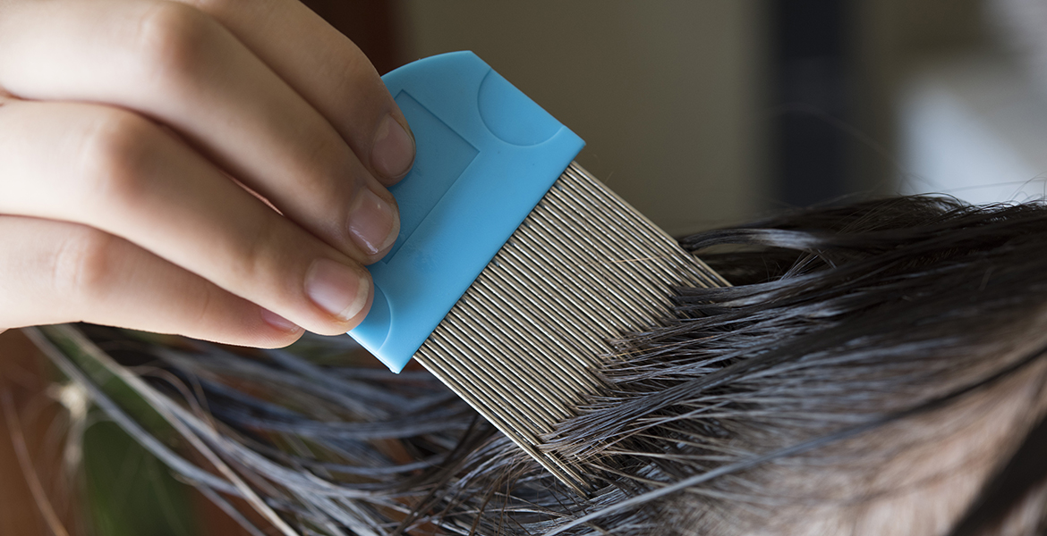 Helping Kids Avoid Head Lice At Summer Camp News And Information
