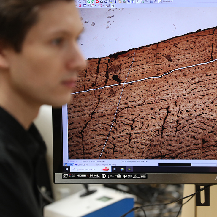 Andy Danison, anatomy and vertebrate paleontology Ph.D. student at OSU Center for Health Sciences, studies a histology slide of one of the fossils he analyzed to determine the maturity of a new genus of Allosaurus. 