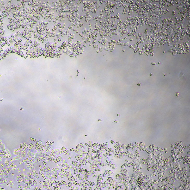 A microscope image of colorectal cancer cells provided by Serene Lim, a PhD biomedical sciences student researching the role of bacteria and inflammation in cancer growth.